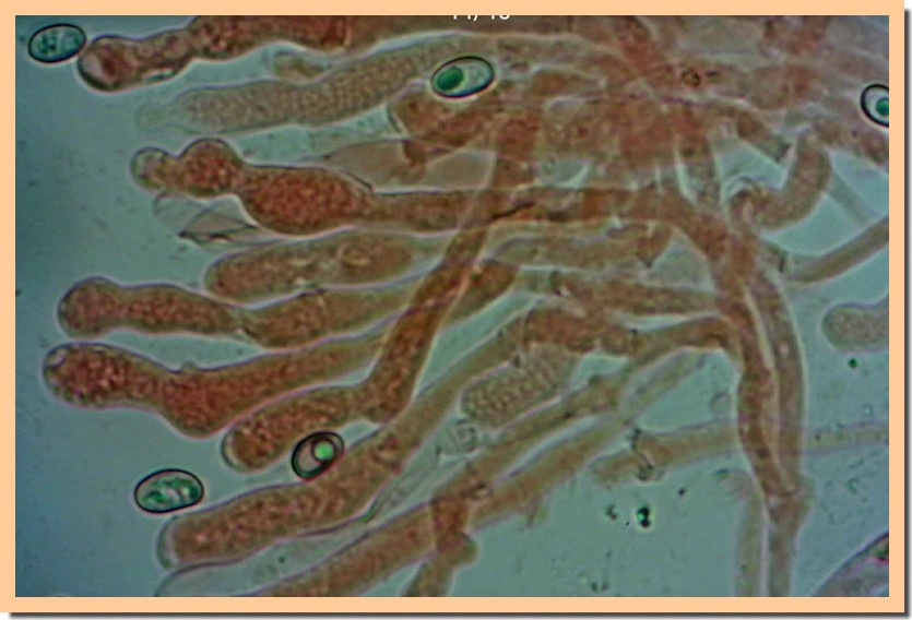 meottomyces dissimulans micro.jpg