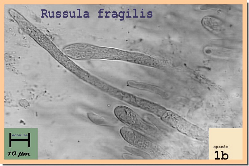 R fragilis micro.jpg