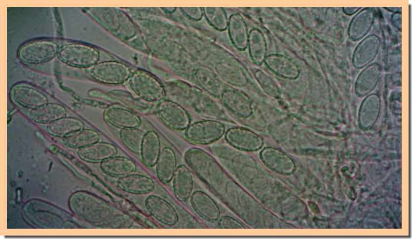 sowerbyella radiculata spores 23.jpg