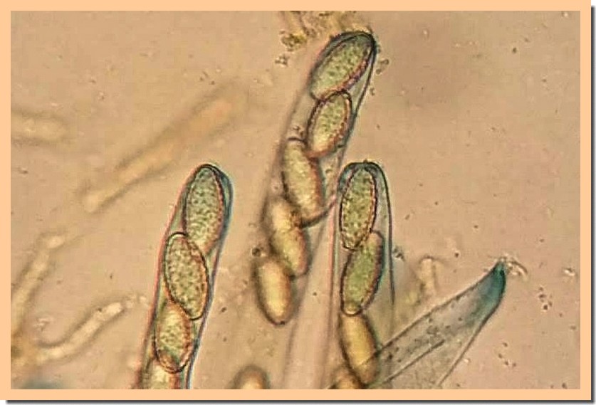 peziza phyllogena micro 2.jpg