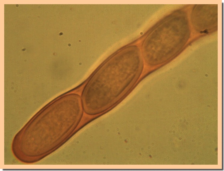 sarcocypha coccinea2.jpg