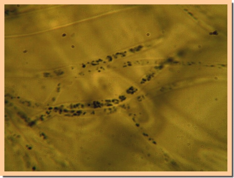 paraphyses sarcoscypha coccinea3.jpg