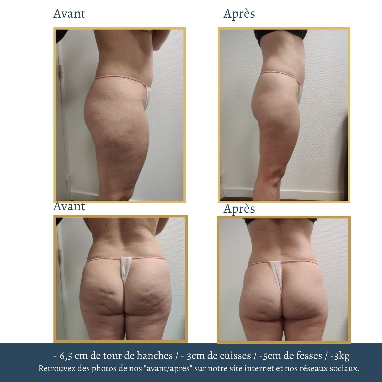 visuels expertise minceur.jpg