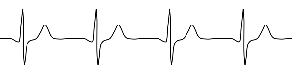 ECG.png