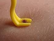 Insectes nuisibles2.jpg