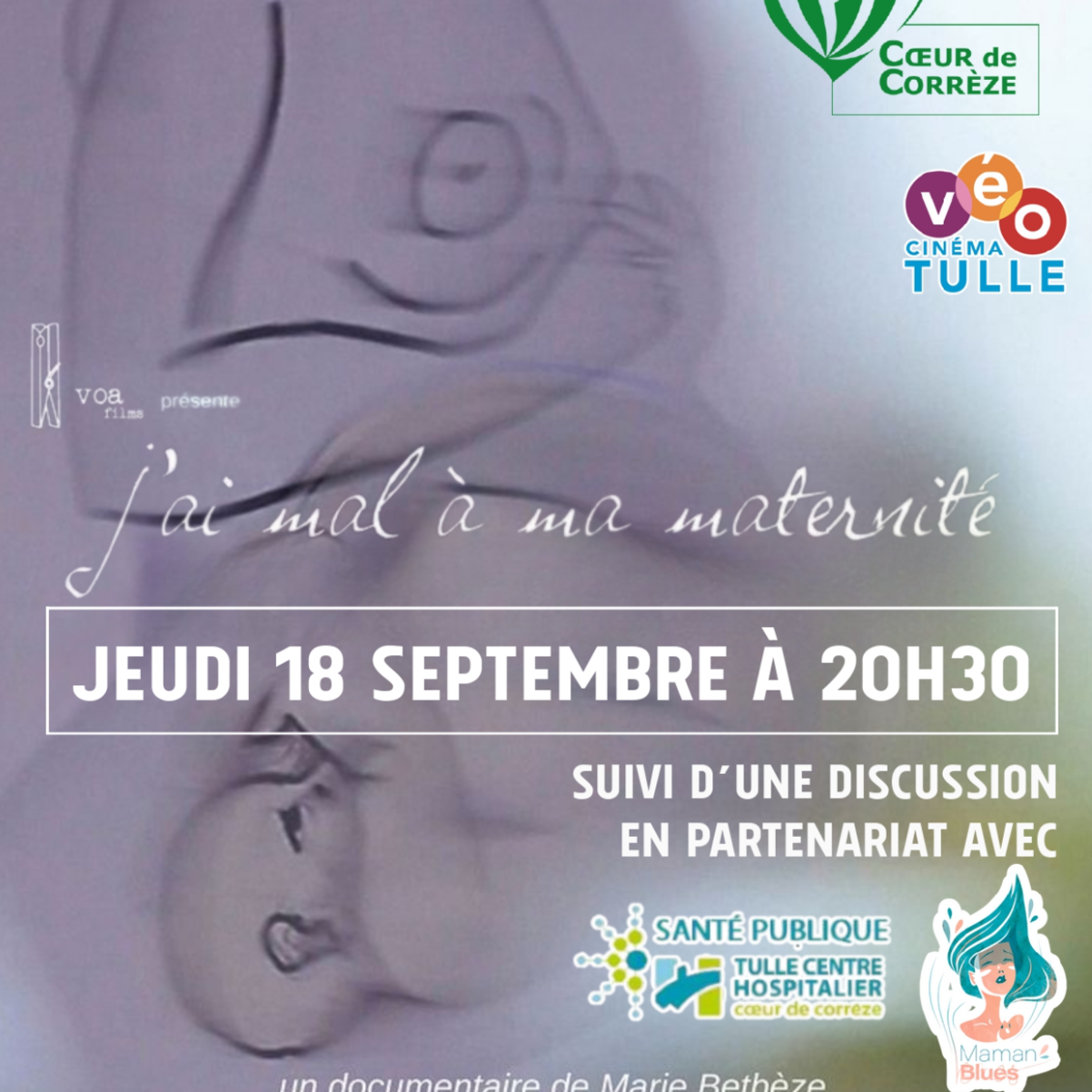 Image par défaut