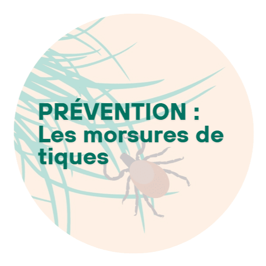 Image par défaut